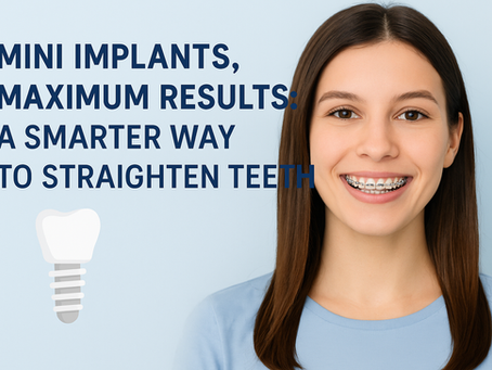 Tiny Screws, Big Smiles – How Mini Implants Help Braces Work Better