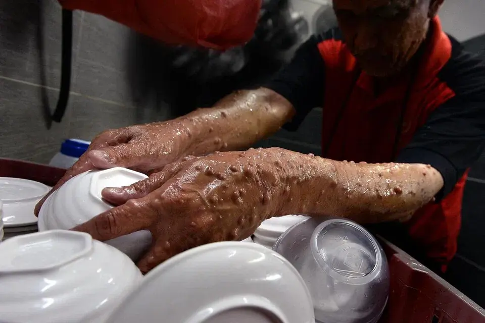 Patient-led group provides social, community support for neurofibromatosis sufferers