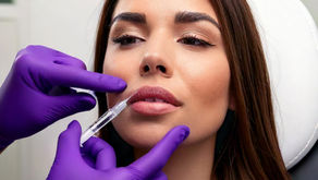 Beneficios inesperados del ácido hialurónico en los labios