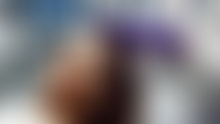 ¿Miedo de inyectarte BOTOX por primera vez?