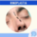 RINOPLASTÍA