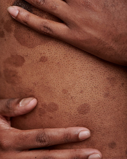Dark Spot treatments at Eros Bodyworks.jpg