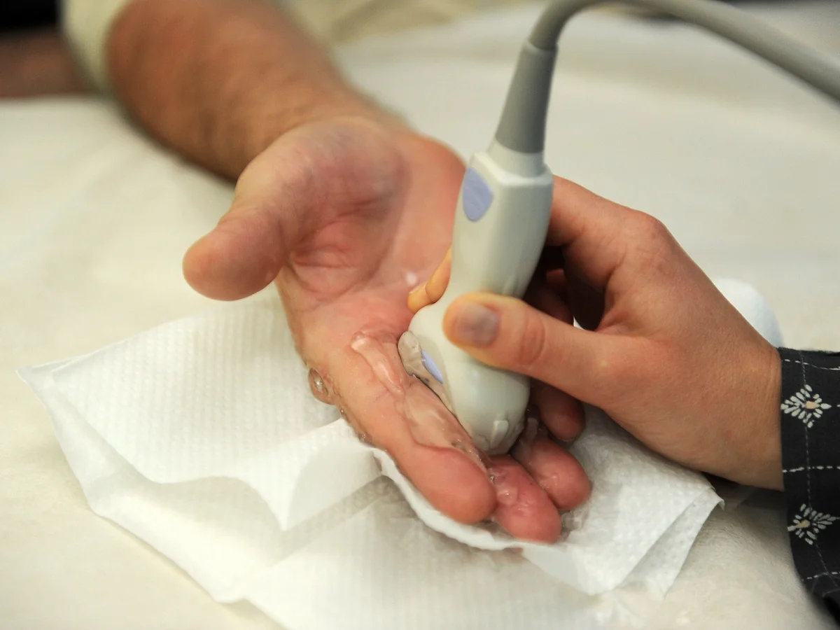 MSK echografie