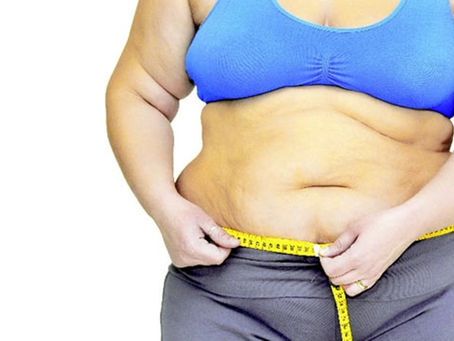 Tihuatlan: "AUMENTA LA OBESIDAD"