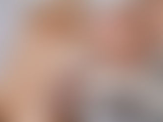 woman getting microneedling treatment