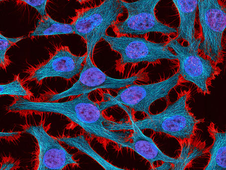 National Institutes of Health. (n.d.). HeLa cells stained for actin, microtubules, and nuclei [Photograph]. National Institute of General Medical Sciences. https://nigms.nih.gov/image-gallery/3521