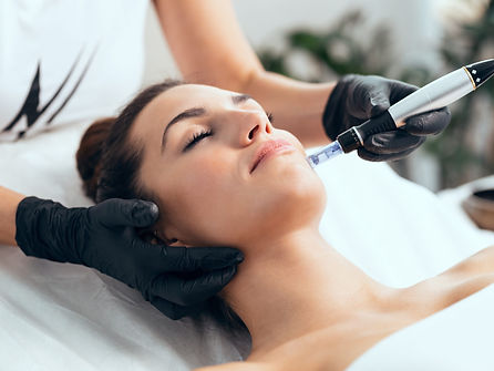 Microneedling Facial