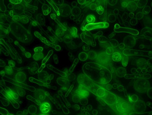 The_accidental_tubules .jpg