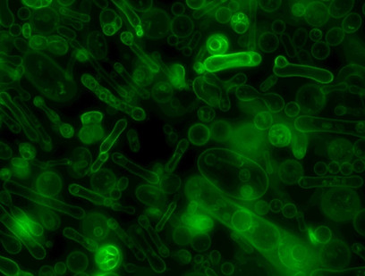 The_accidental_tubules .jpg