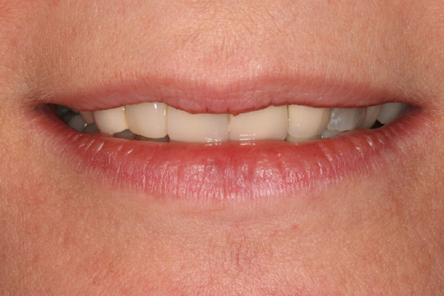 Patient 8 Before