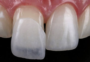 32574d_bc89189c73b1498cb192164c5ae0062b~