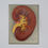 Thumbnail: Anatomical model of the human kidney