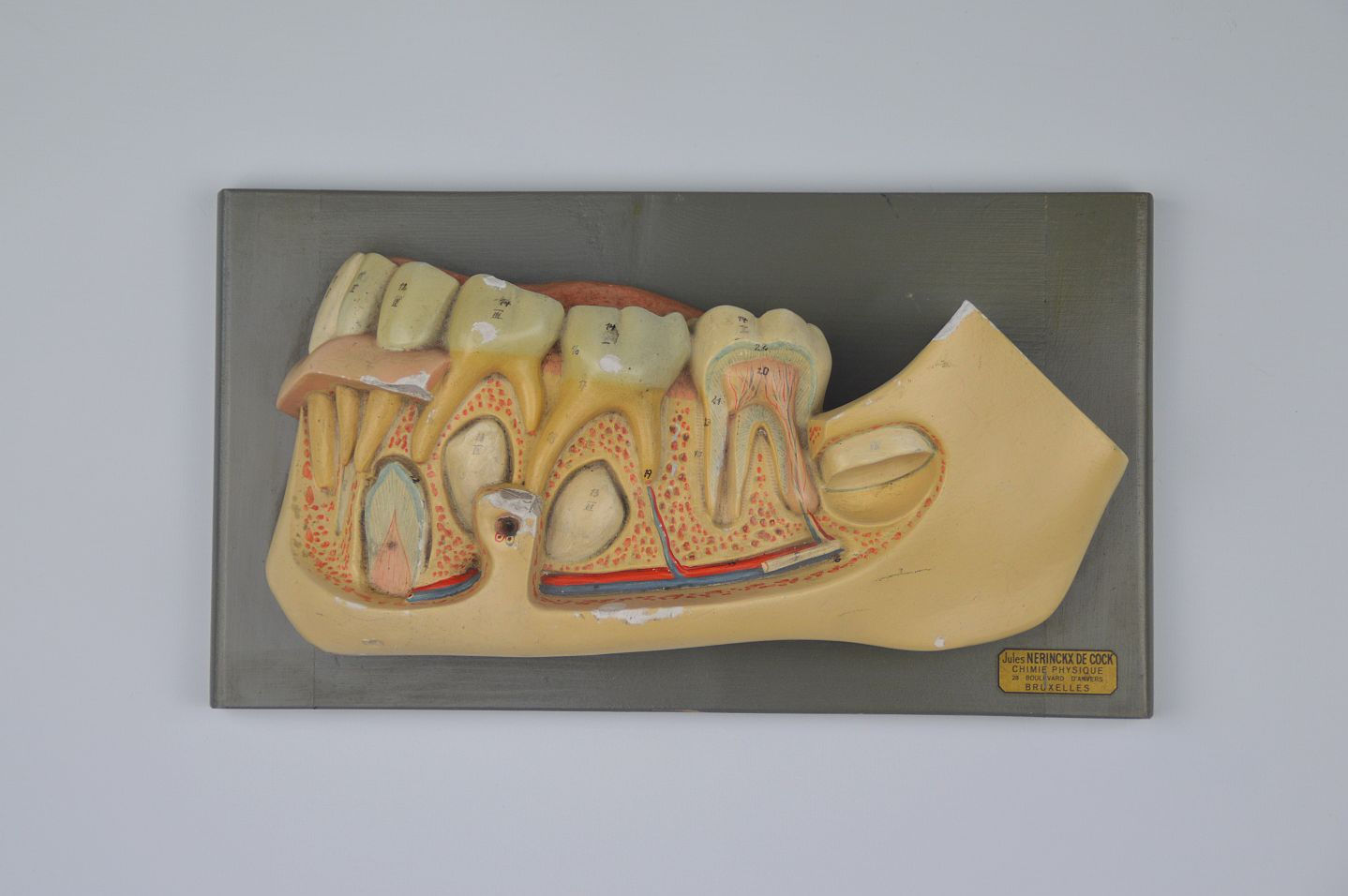 Didactisch anatomisch model in gips van de kaak met tanden