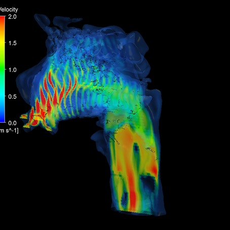 A volume rendering of velocity speeds in the upper airways