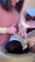 Botox and Daxxify treatment at Ilume Aesthetics in Stoughton, WI