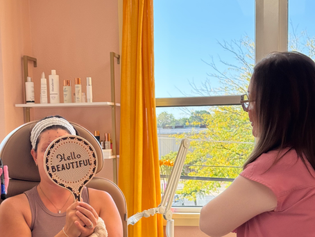 Botox, Filler, or Microneedling? How to Choose the Right Summer Refresh Treatment