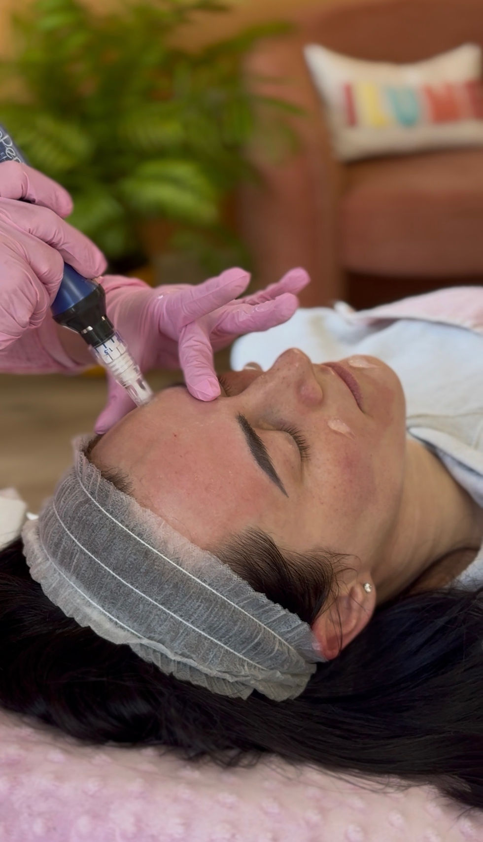 Microneedling treatment for skin rejuvenation and collagen support