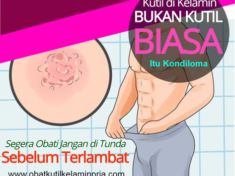 Cara Mengobati Kutil Kelamin Pada Wanita Secara Alami