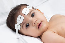 neonatal_clsh_032o3_061020191.jpg