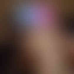 Resting up a bit after surgery on my broken ankle