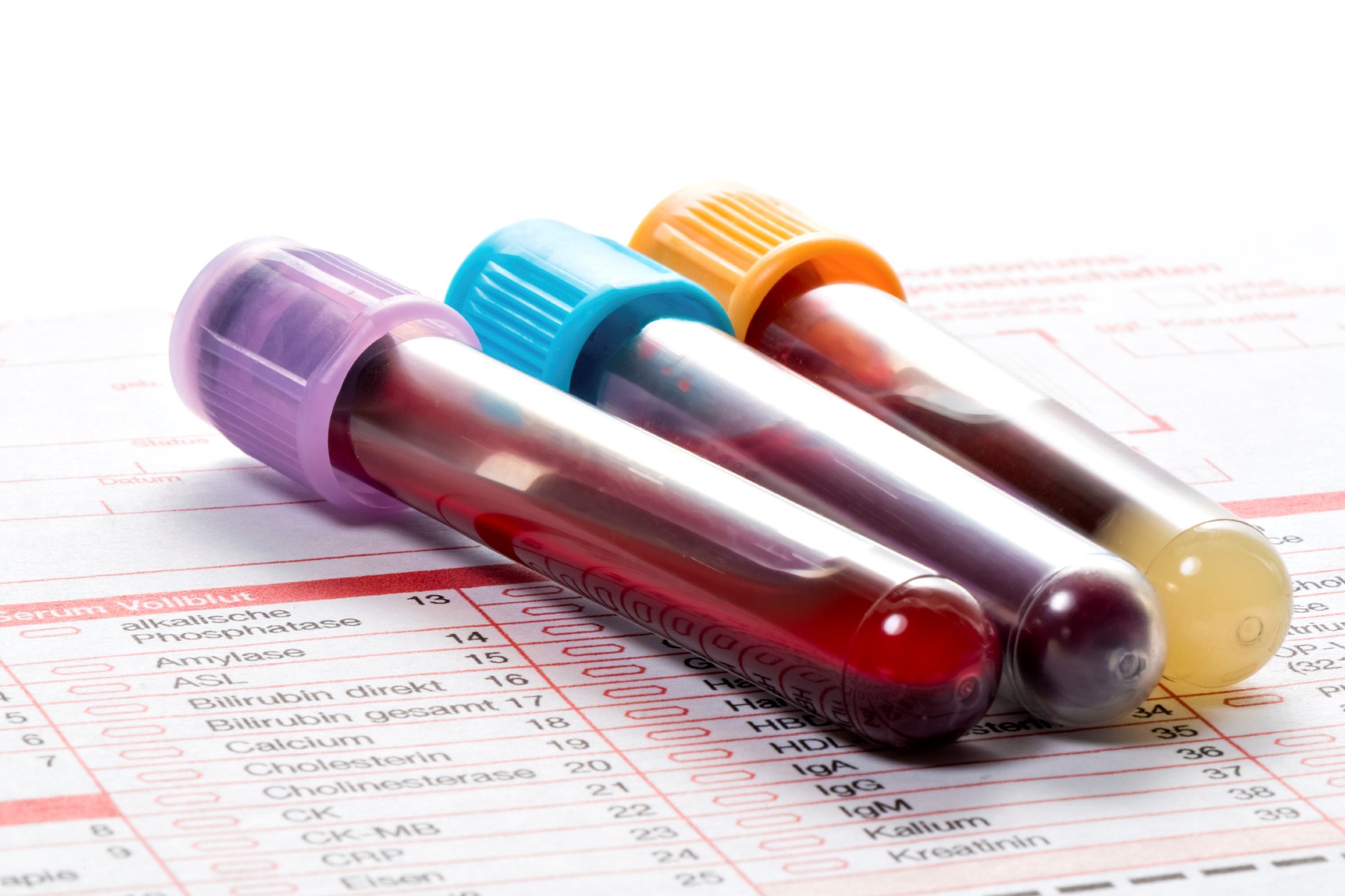 Is Your Blood Working For You Find Out Now - qv6obva