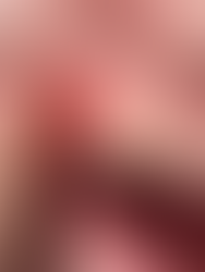 Le cisti orali: un problema comune ma poco conosciuto