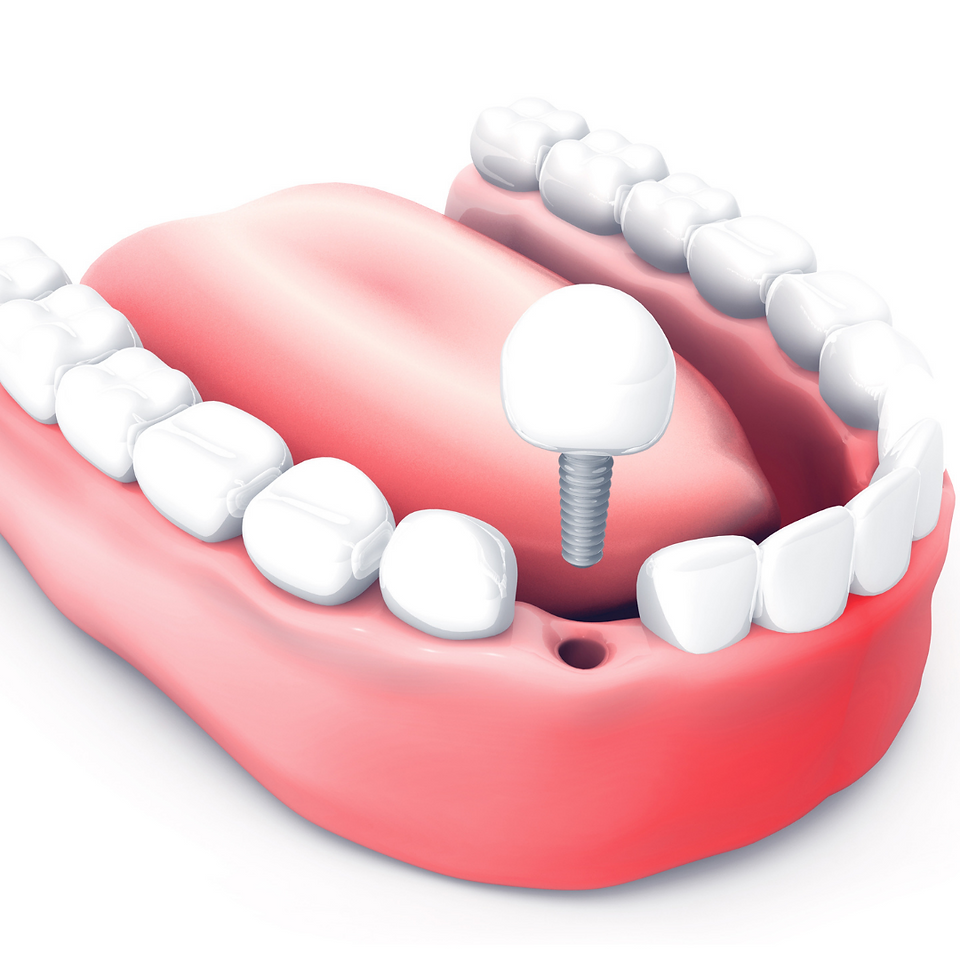cure dentali di altissima qualità
