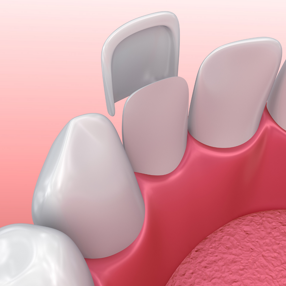 cure dentali di altissima qualità