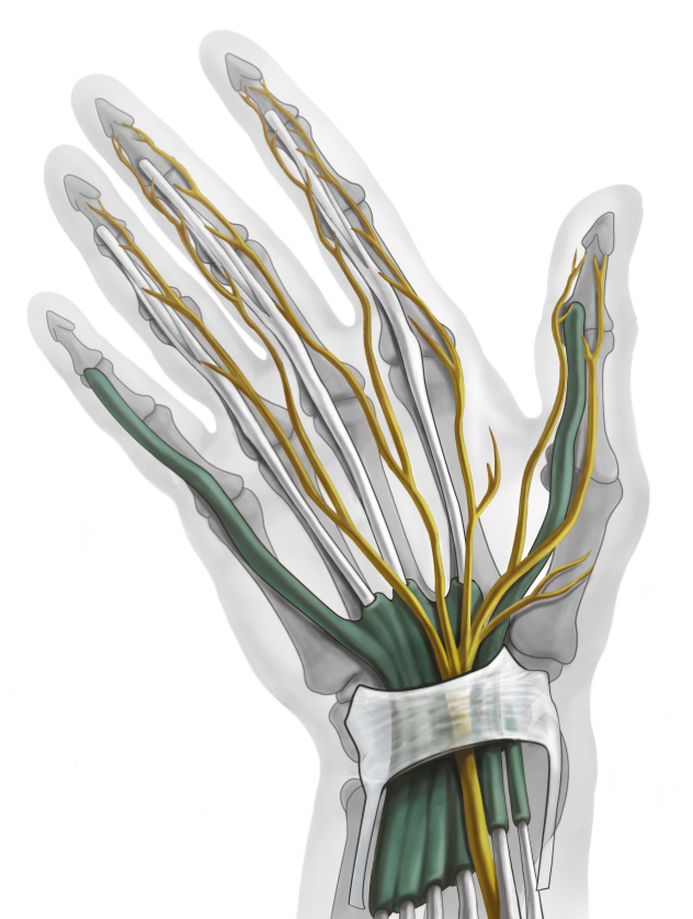 Hand surgery