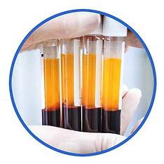 image showing blood after it has been spun down in centrifuge separating PRP