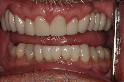 cas 16 après(1).jpg