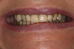 centre-dentaire-3r-cas-design-sourire-av