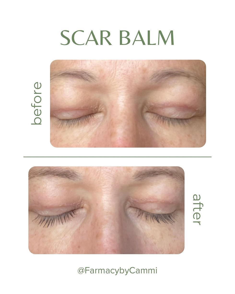 Thumbnail: Scar Balm