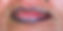 Athena Corrective Lips Before 1
