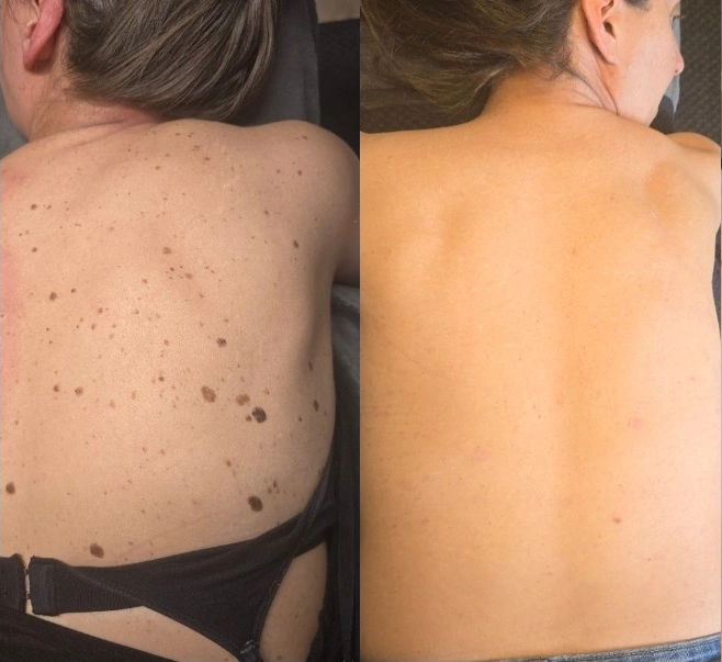 Behandlingar för ansikte & kropp hos Optima