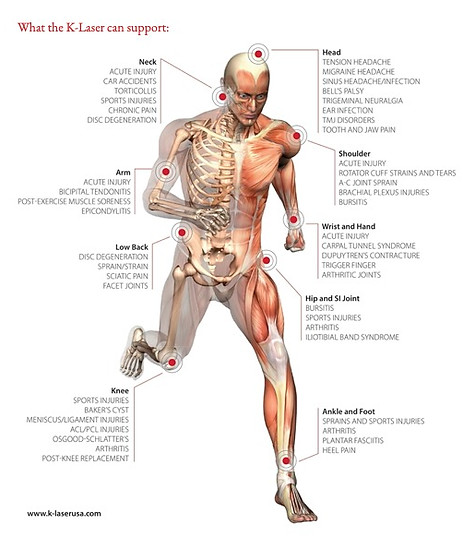 K-laser support head to toe applications pdf copy.jpg