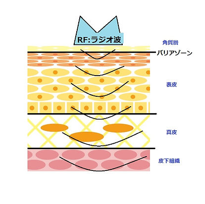EMS|RF|エレクトロポーション|エレポ|elepo|たるみ改善|しわ改善|シワ・タルミケア|Nature ナチュール 、エイジングケア、 シミケア シワタルミケア、小顔、リンパオイルマッサージ、ヘッドマッサージ、尼崎、武庫之荘、兵庫県、尼崎市、伊丹市、西宮市、塚口、西宮北口