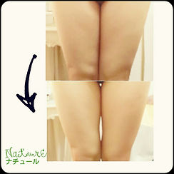 痩身｜キャビテーション｜ラジオ波｜ＥＭＳ｜キャビスパforpro｜Nature～ナチュール～｜部分痩せ｜足痩せ｜お腹やせ｜くびれ｜兵庫県尼崎市