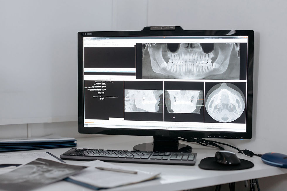 Digital dental X-ray on a monitor, supported by dental office IT support