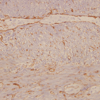 Immunohistochemistry services