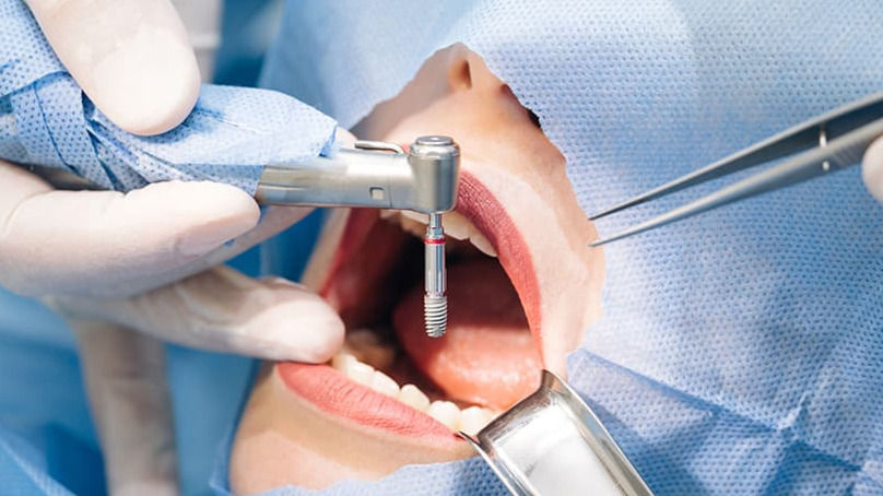 Servicios dentales