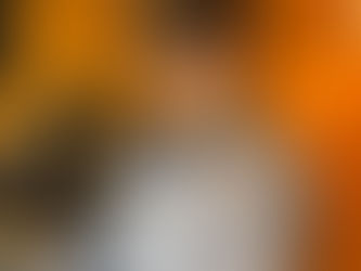 Direct Anterior Composites Barcelona