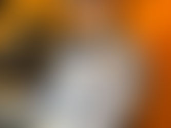 Direct Anterior Composites Barcelona