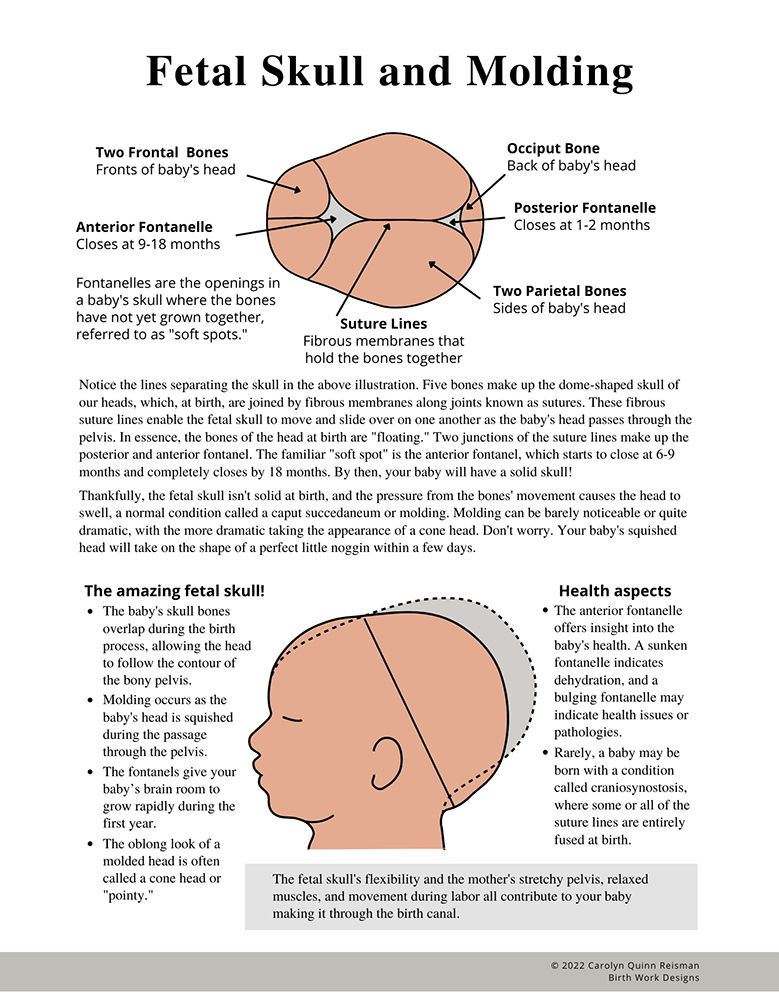 Thumbnail: Fetal Skull and Molding