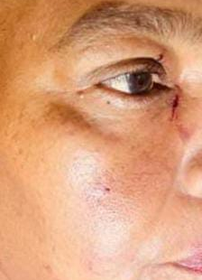 Briga por ciúmes termina em agressão à própria mãe em Jataí