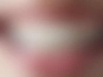 Understanding the Dental Veneers Cost: What You Need to Know