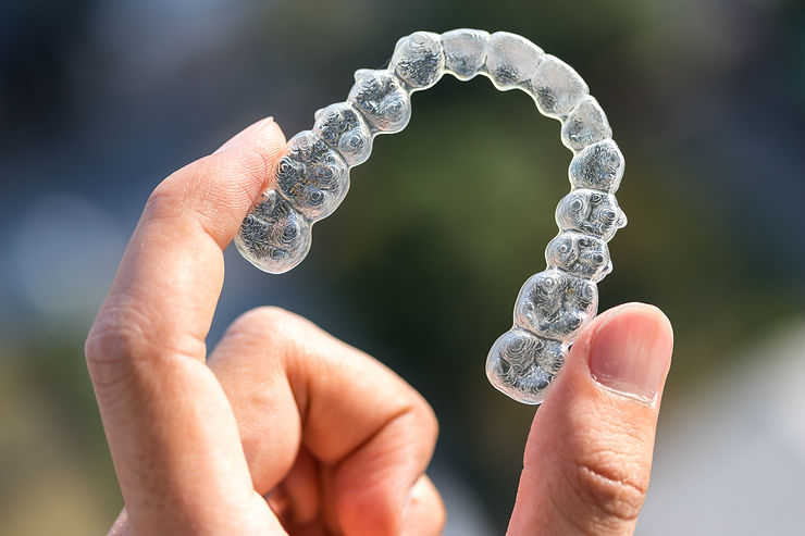 Apparecchi invisibili per allineare i denti in maniera discreta