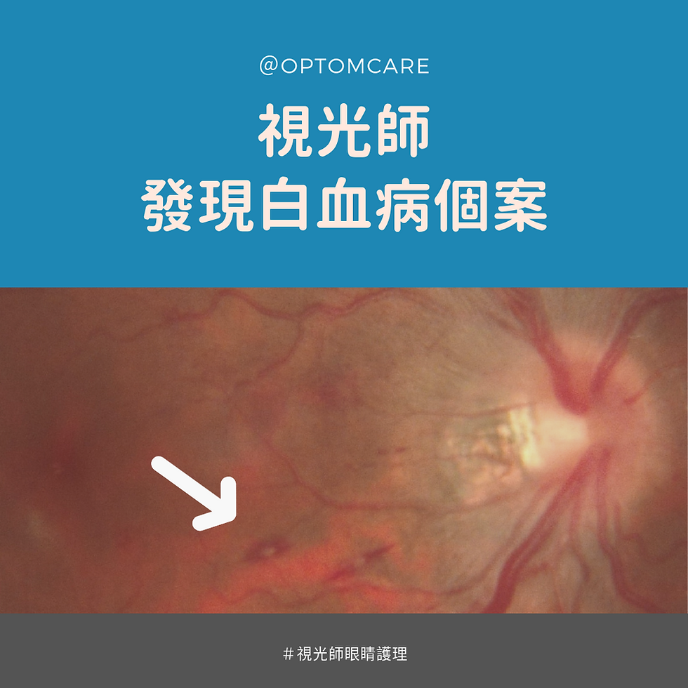 視光師發現白血病個案