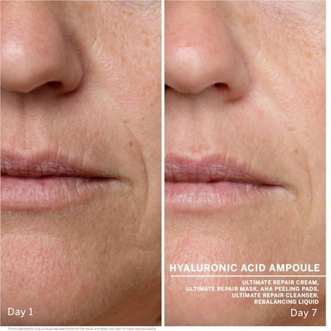 Miniaturbild: Hyaluronic Acid Ampoule Set