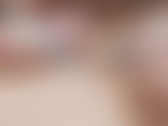 Electrolysis Hair Removal Mulgrave: The Only Permanent Solution